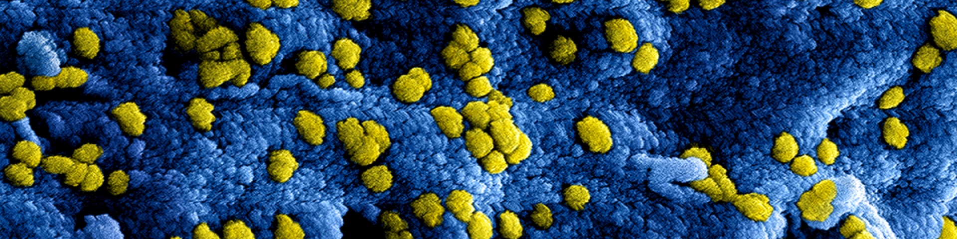 Coronavirus banner